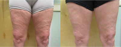 before and after image