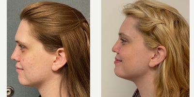 before and after image