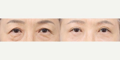before and after image