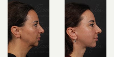before and after image