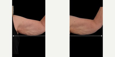before and after image