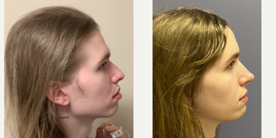 before and after image