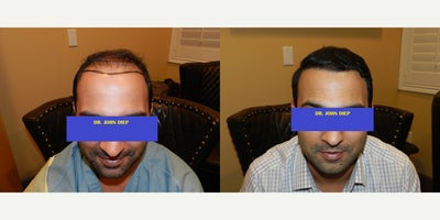 before and after image