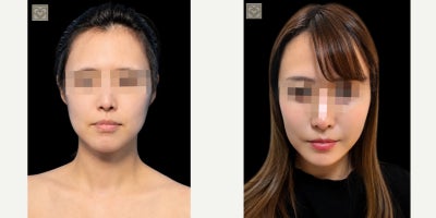 before and after image
