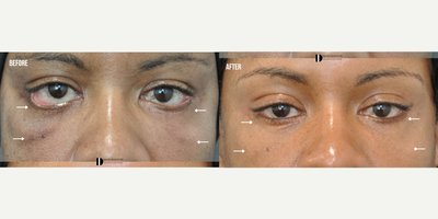 before and after image