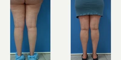 before and after image