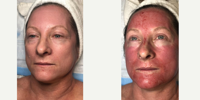 before and after image