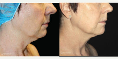 before and after image