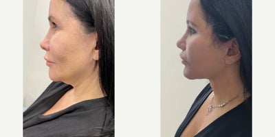 before and after image
