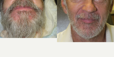 before and after image