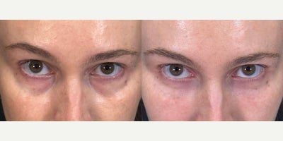 before and after image