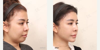 before and after image