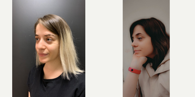 Rhinoplasty before and after photo
