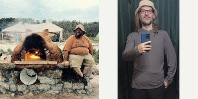 Duodenal Switch before and after photo