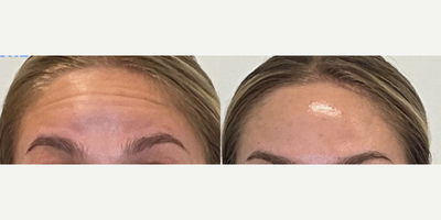 before and after image