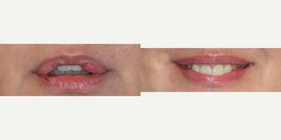 before and after image