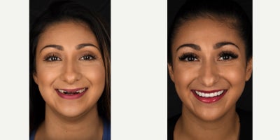 before and after image