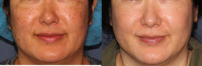 before and after image