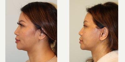 before and after image