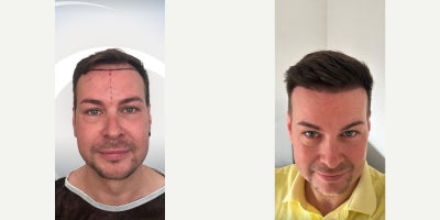 before and after image