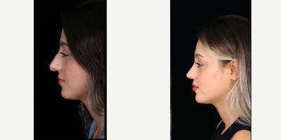 before and after image