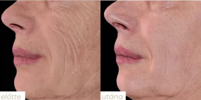 before and after image