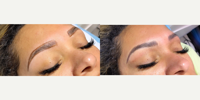 Microblading before and after photo