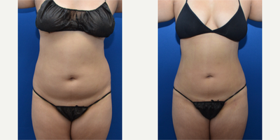 before and after image