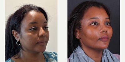 before and after image