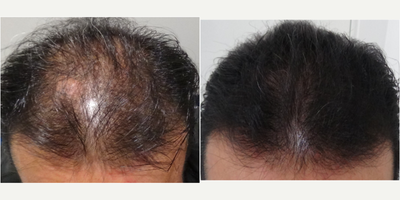 before and after image