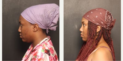 before and after image