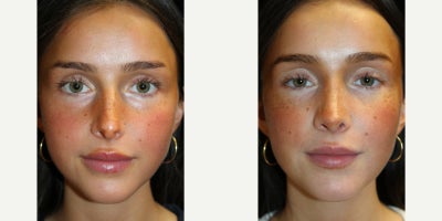 before and after image