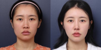 before and after image