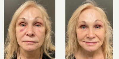 before and after image