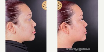 before and after image