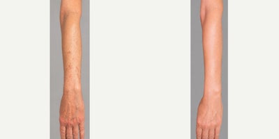 before and after image