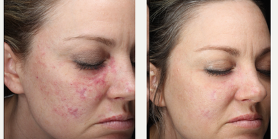 before and after image