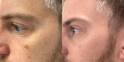 before and after image
