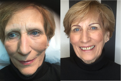 Permanent Makeup before and after photo
