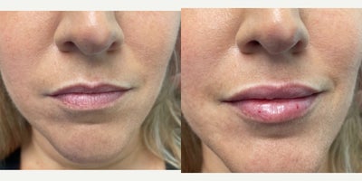 before and after image