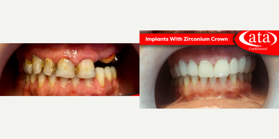 before and after image