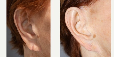 before and after image