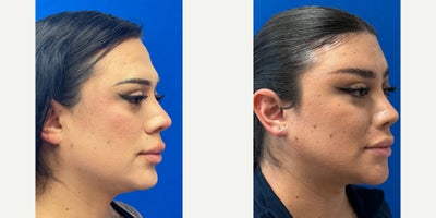 before and after image