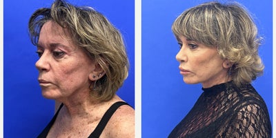 before and after image