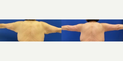 before and after image