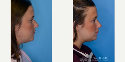 before and after image