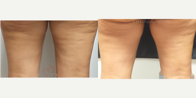 before and after image