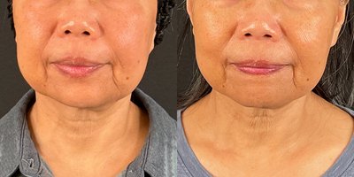 before and after image