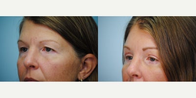 before and after image