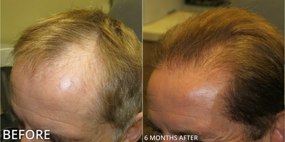 before and after image